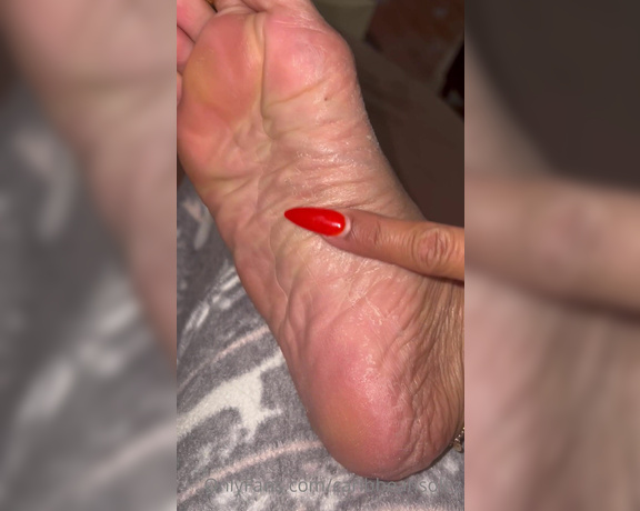 Caribbean Solez aka Caribbeansolez OnlyFans - Foot peel update…day 3 and they are looking dry af but going to trust the process Can you moistu