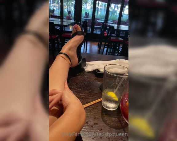 Fetishxqueen aka Fetishxqueen OnlyFans - Another Cast adventure! Swipe to watch me crutch  Kinda badly though but what a lucky doc ! 9