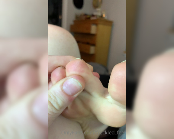 Freckled Feet aka Freckled_feet OnlyFans - Look at this yummy toe jam! What kind of toe jam content would y’all like to see