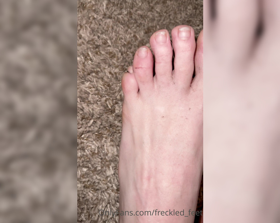 Freckled Feet aka Freckled_feet OnlyFans - I worked up quite a bit of toe jam today!