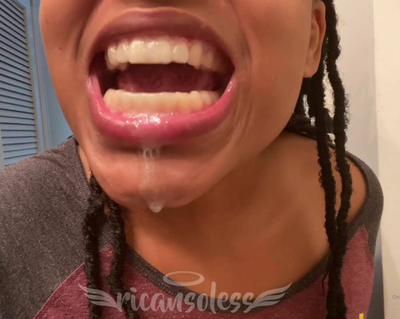 Mama Rican aka Ricansoless OnlyFans - My new whitening trays make me drool I’m a goof