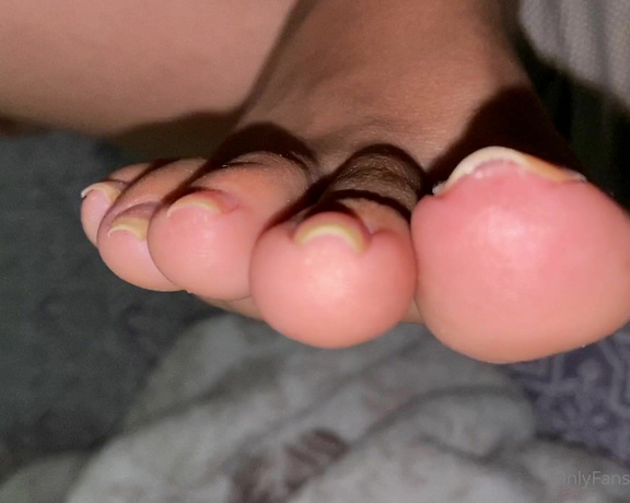 Feetmissy aka Feetmissy OnlyFans - Still working on my nails 3 more months before I could totally stop wearing these braces