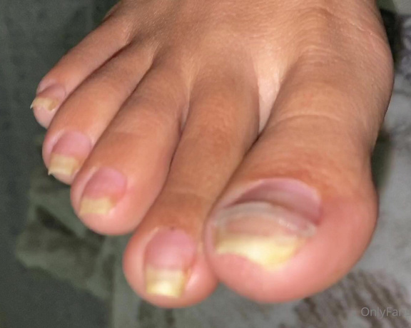 Feetmissy aka Feetmissy OnlyFans - Still working on my nails 3 more months before I could totally stop wearing these braces
