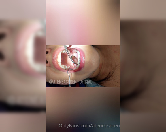 Atenea Seren aka ateneaseren OnlyFans Video - I really love going to my dentist appointments