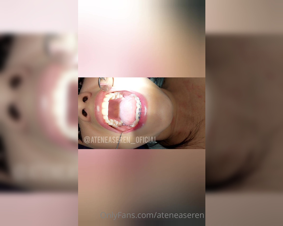 Atenea Seren aka ateneaseren OnlyFans Video - I really love going to my dentist appointments