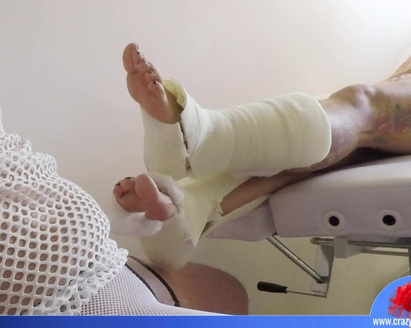 Crazy Samanta - Cast Footjob - Gips Footjob #Cast #Footjob #Foot Fetish