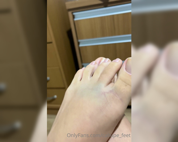 Caliupe Feet aka caliupe_feet Foot Fetish - 02-20-2023 OnlyFans Video - Cai de moto semana passada, por isso o roxo dos pés