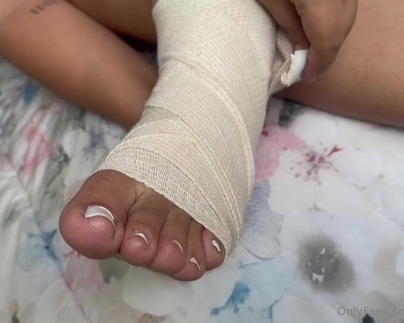 Herafeet91 aka herafeet91 - 08-21-2024 OnlyFans Video - Sprain Feet Buenos días mis niños  última parte de este video, una torcedura de tobillo