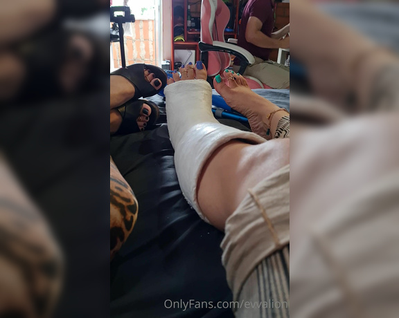 EvvaLion aka evvalion - 03-03-2021 OnlyFans Video - This last weekend My caster put a Short leg cast in yelahiag s Leg