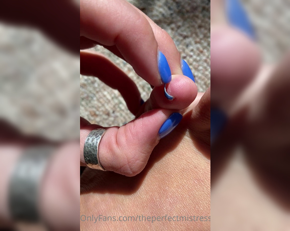 ThePerfectMistress aka Theperfectmistress OnlyFans - Super close up of my toe fuzzzz  remember when I stubbed my toe recently and it bled yeah,,,